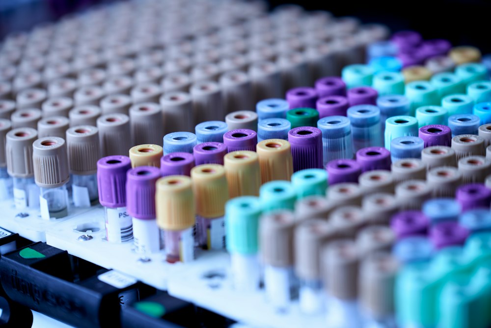 Gradilla con tubos de ensayo de laboratorio para análisis de sangre